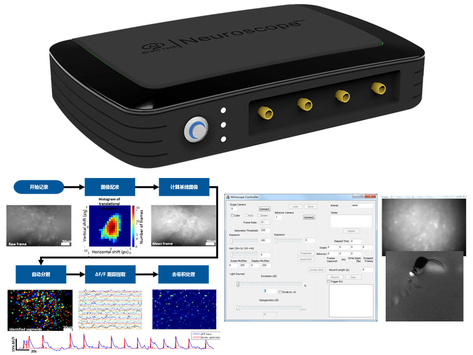NeuroScope-超微型顯微成像系統